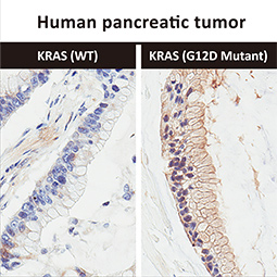 RAS (G12D Mutant) antibody [HL10] (GTX635362)